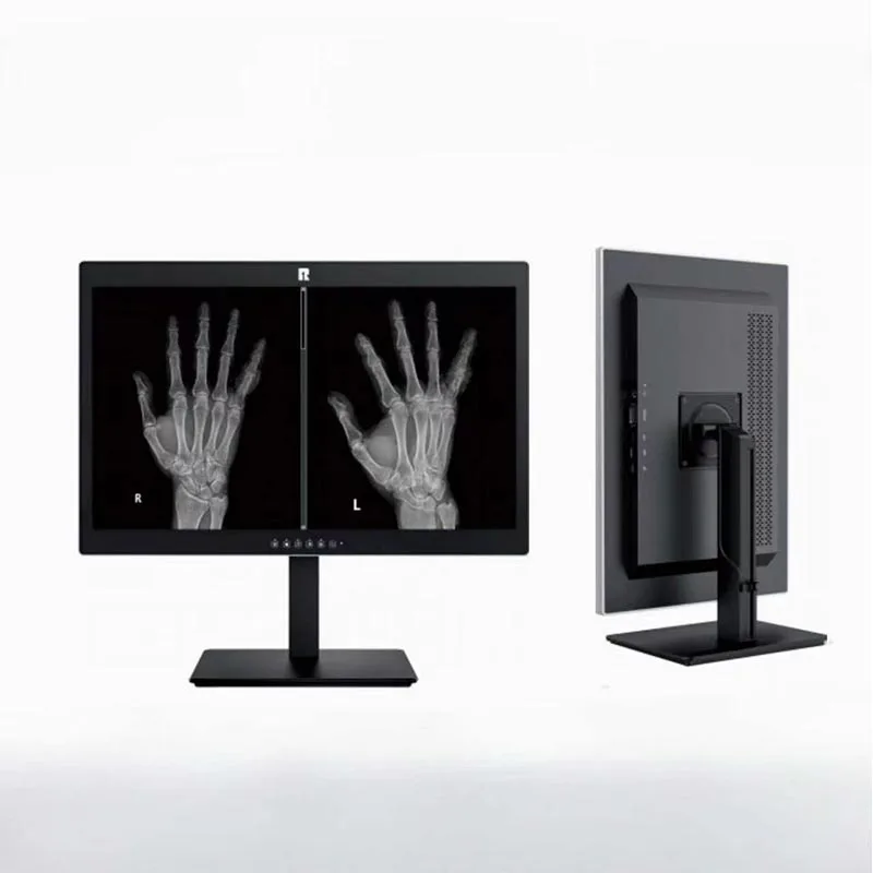 20,1-дюймовый медицинский диагностический дисплей с разрешением 2 МП