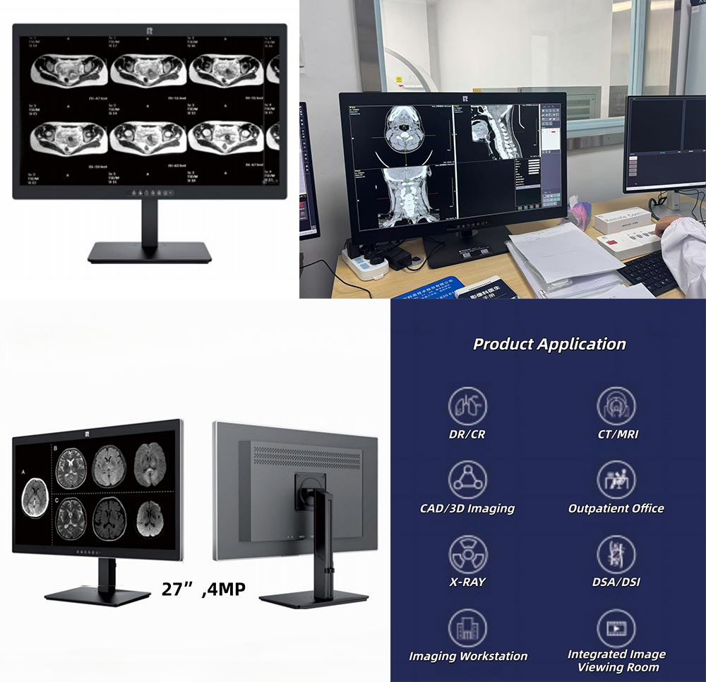 27-inch 4MP Medical Diagnostic Monitor